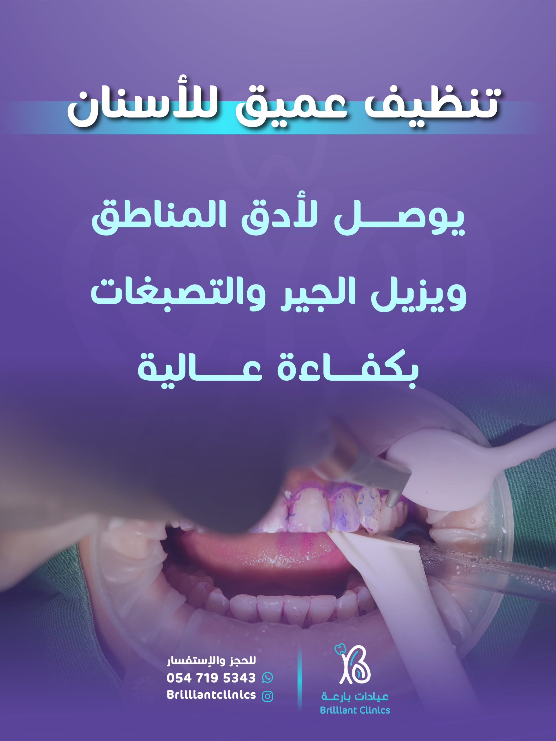 منشور جهاز اي بي سي-05